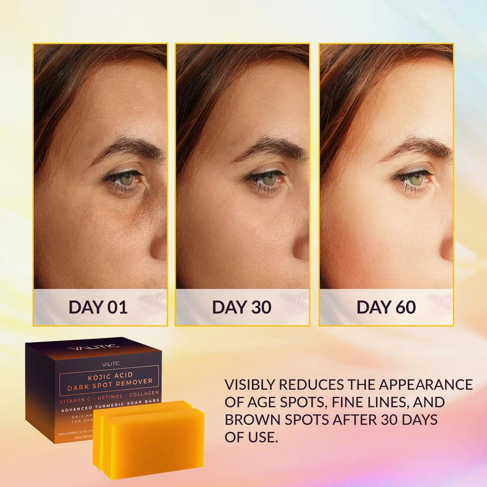 VALITIC Kojic Acid Turmeric Soap Bar